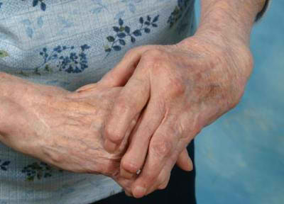 ¿Hay una Cura para la Artritis Reumatoidea?