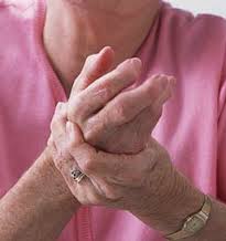 4 Remedios Caseros para la Artritis Cr贸nica